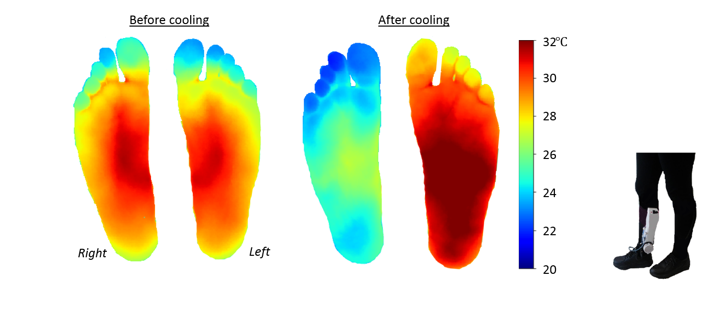 insoles for diabetic feet